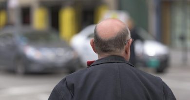 Clascoterone 5% : essais cliniques montrent un effet sur la calvitie chez l'homme