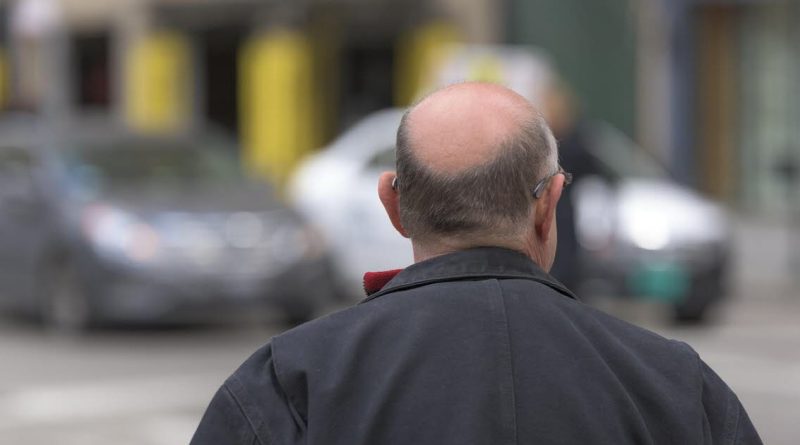 Clascoterone 5% : essais cliniques montrent un effet sur la calvitie chez l'homme