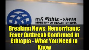 Épidémie de fièvre hémorragique confirmée en Éthiopie : infos clés.