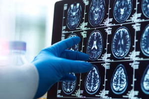 Ce complément à moins de 10 € améliore la mémoire des personnes de plus de 60 ans