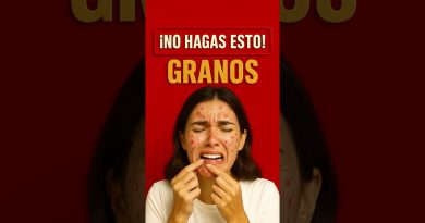 Évitez ces erreurs face à l’acné : ce que votre corps révèle À ÉVITER ABSOLUMENT EN CAS D'APPARITION D'UN GRANO