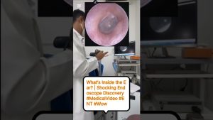 À la Découverte de l'Intérieur de l'Oreille ! 👂😳