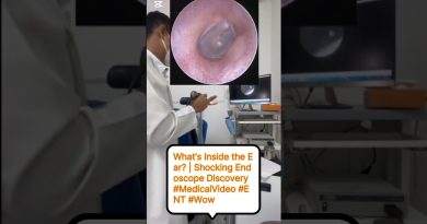 À la Découverte de l'Intérieur de l'Oreille ! 👂😳