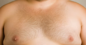 Chez certains hommes, la poitrine peut produire du lait: un phénomène rare