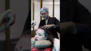 Ce que les experts cachent sur le PRP pour la repousse capillaire