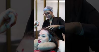 Ce que les experts cachent sur le PRP pour la repousse capillaire