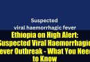 Éthiopie en alerte : Épidémie suspectée de fièvre virale