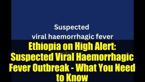 Éthiopie en alerte : Épidémie suspectée de fièvre virale