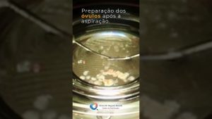 Préparation des ovules après aspiration en FIV
