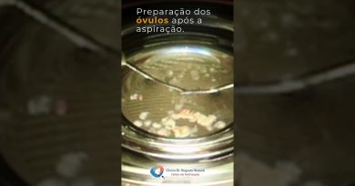 Préparation des ovules après aspiration en FIV