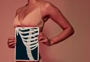 «Rib remodeling» : se faire casser des côtes pour obtenir une taille de guêpe, est-ce judicieux ?