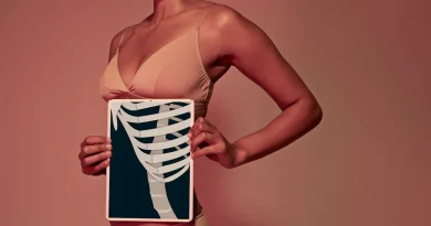 «Rib remodeling» : se faire casser des côtes pour obtenir une taille de guêpe, est-ce judicieux ?