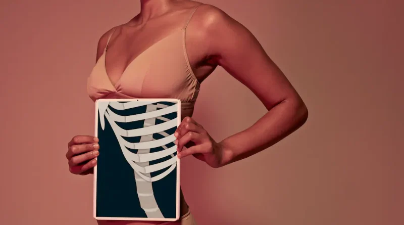 «Rib remodeling» : se faire casser des côtes pour obtenir une taille de guêpe, est-ce judicieux ?