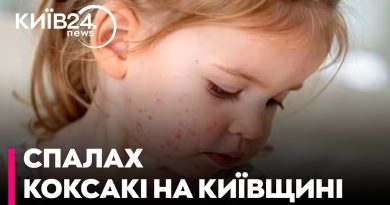 Virus Coxsackie à Kyiv : dangers et conseils d'Alia Mironenko
