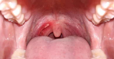 Une consommation d’alcool quotidienne, même faible, augmente le risque de cancer buccal en Inde Une consommation quotidienne d'alcool pourrait augmenter le risque de cancer buccal