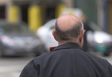 Santé : Clascoterone 5% — que montrent les études sur son efficacité contre la calvitie ?