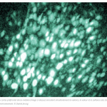 Impact des émotions sur nos décisions : un lien essentiel en santé mentale