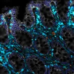 Des scientifiques découvrent comment aider les intestins vieillissants à se régénérer.