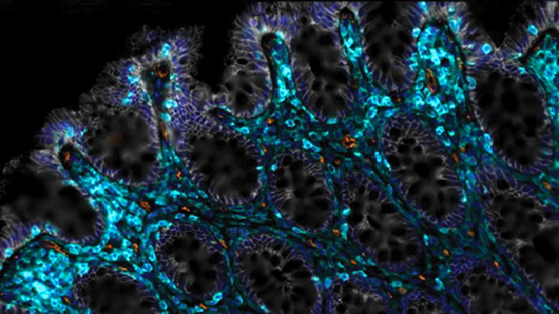 Des scientifiques découvrent comment aider les intestins vieillissants à se régénérer.