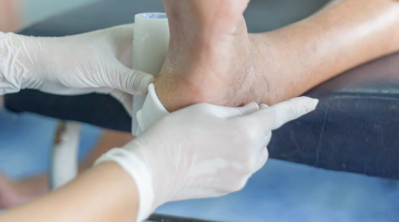 Santé : Ulcère du pied diabétique, un quart des patients subissent une amputation après le premier épisode