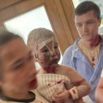 Guerre systématique contre les civils : une réalité alarmante à travers le monde