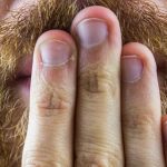 Un homme de 52 ans guérit de son hoquet de vingt ans grâce à un traitement électrique