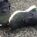 Un intérimaire amputé d’un bras après un accident de travail reçoit des chaussures à scratch à l’hôpital