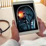 Méningite : un fléau mondial en déclin, mais à un rythme préoccupant