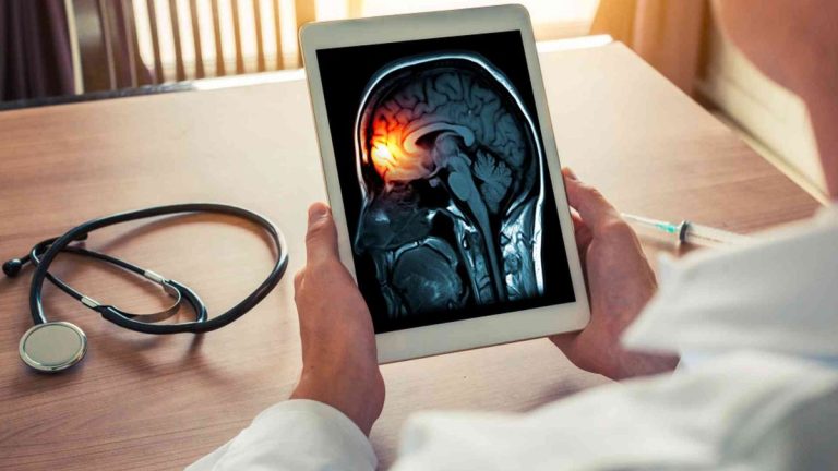 Méningite : un fléau mondial en déclin, mais à un rythme préoccupant