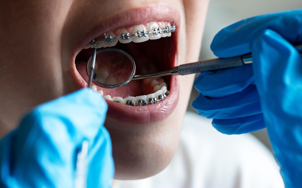 Nouveaux orthodontistes à Coutances : conditions de consultation et types de problèmes traités
