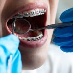 Nouveaux orthodontistes à Coutances : conditions de consultation et types de problèmes traités