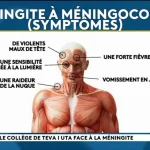 Cluster de méningites au Royaume-Uni, un cas de méningocoque à Papeete : vigilance face à une maladie rare mais foudroyante
