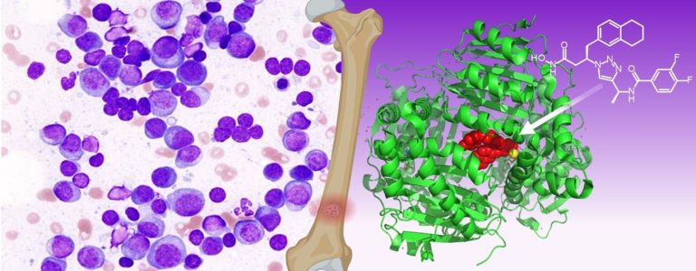 Une enzyme dégradant l'insuline comme biomarqueur et cible thérapeutique dans le myélome multiple