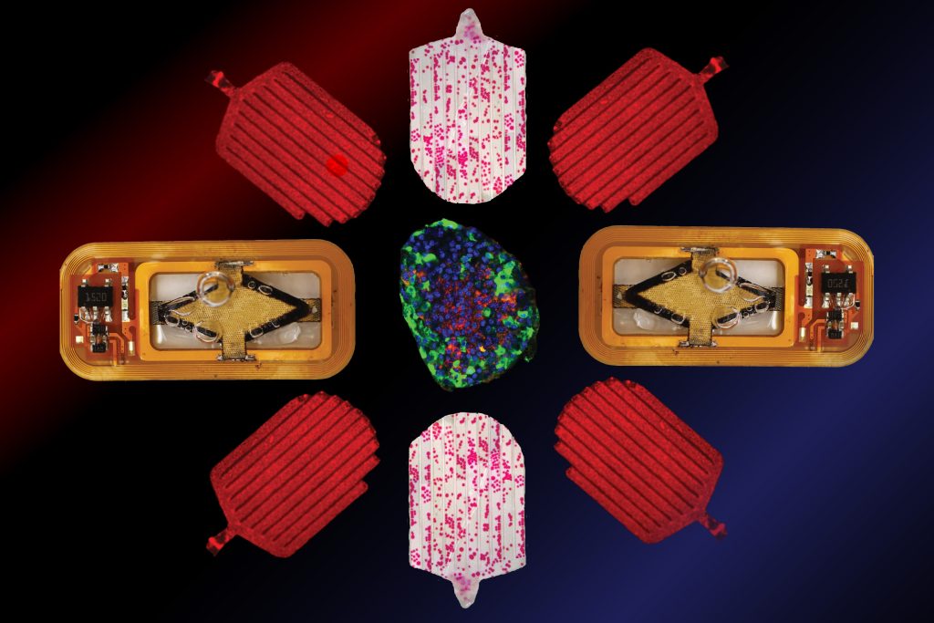 Des cellules îlots implantables pourraient contrôler le diabète sans injections d'insuline.