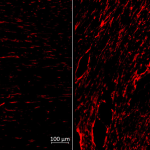Vaccins à ARNm : une nouvelle stratégie de défense contre les maladies révélée par l'Inserm