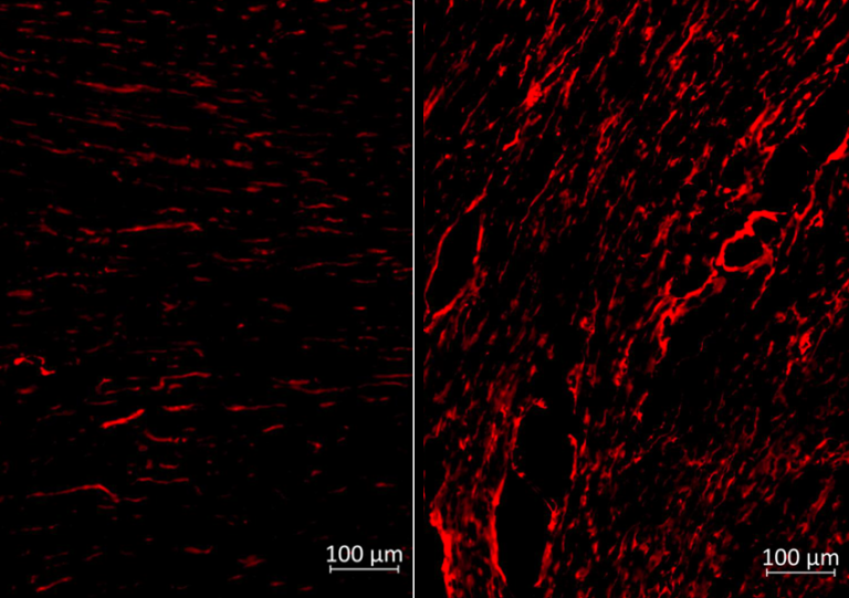 Vaccins à ARNm : une nouvelle stratégie de défense contre les maladies révélée par l'Inserm