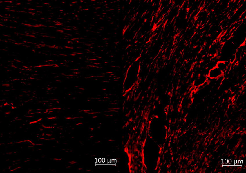 Vaccins à ARNm : une nouvelle stratégie de défense contre les maladies révélée par l'Inserm