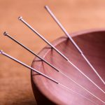 Acupuncture en cancérologie : informations essentielles et pratiques actuelles