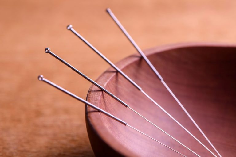 Acupuncture en cancérologie : informations essentielles et pratiques actuelles