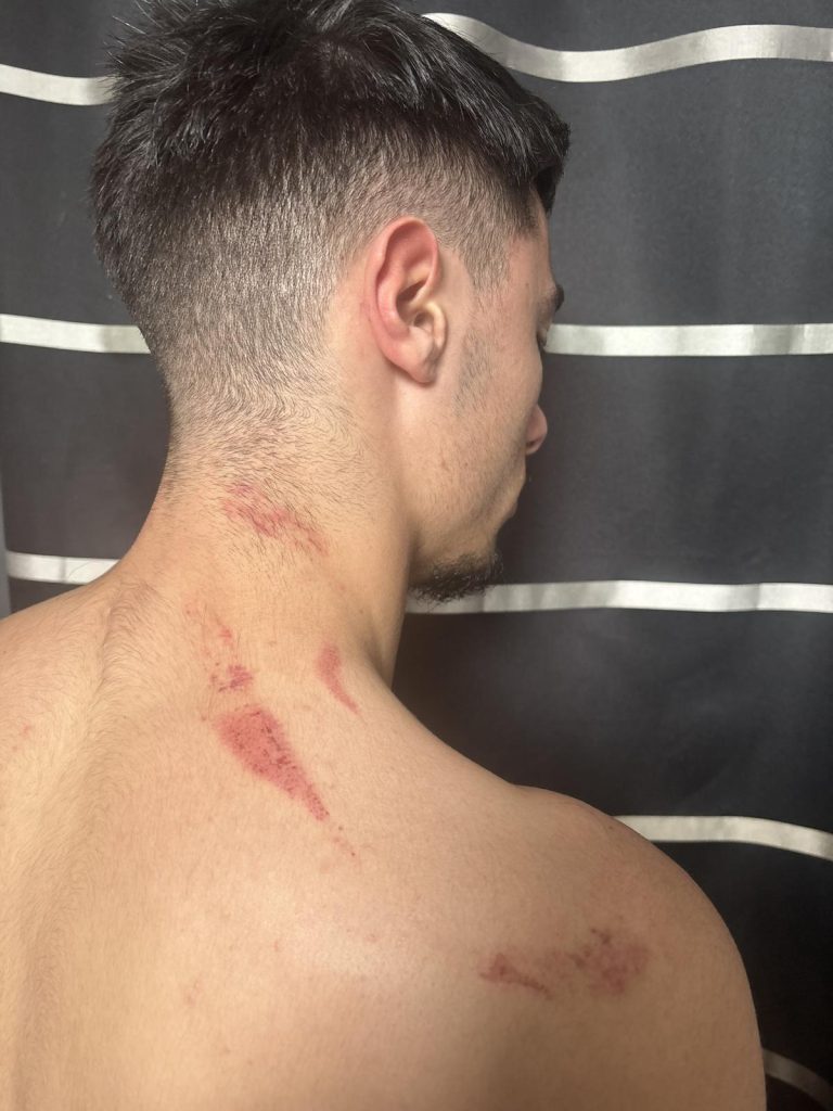 « Bergeracois écroués après avoir frappé un joueur de Mouthiers à 30 mètres »