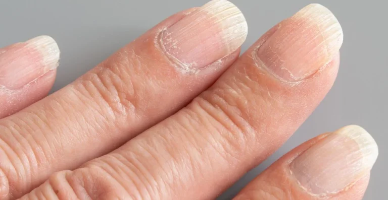 Ongles striés : un soin Aroma-Zone à moins de 4 € pour lisser les stries en relief