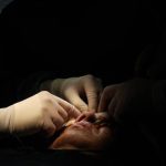 Dans les villes RN, les hôpitaux deviennent des foyers d'infections pour les soldats ukrainiens blessés !