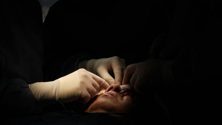 Dans les villes RN, les hôpitaux deviennent des foyers d'infections pour les soldats ukrainiens blessés !