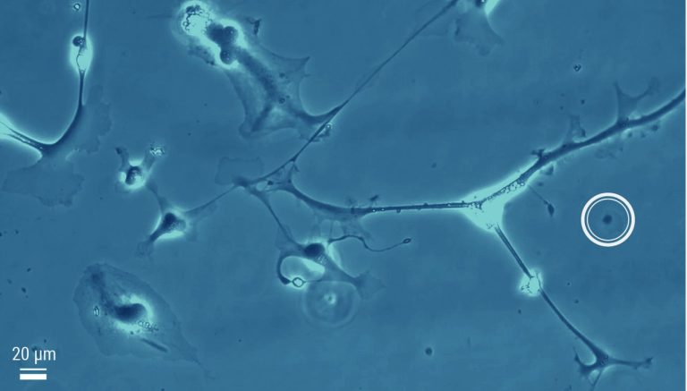 Les Zombosomes : Quand le Cerveau Se Met à Propager des Idées Malades
