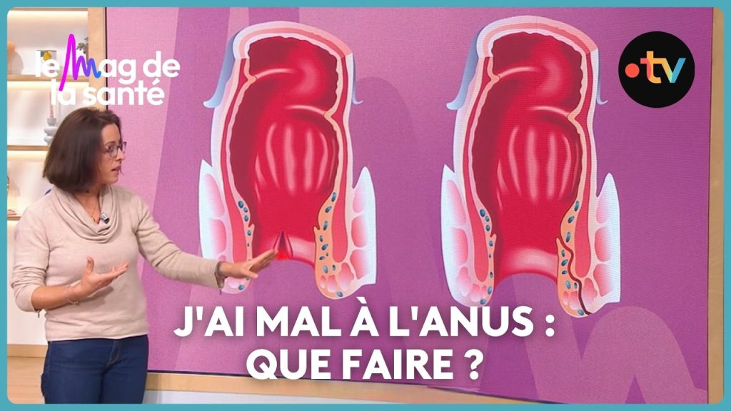 Différences cliniques entre crise hémorroïdaire et fissure anale en France.