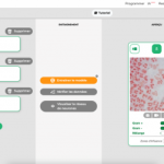 L’IA peut-elle être entraînée à la lecture d’une coloration de Gram ?