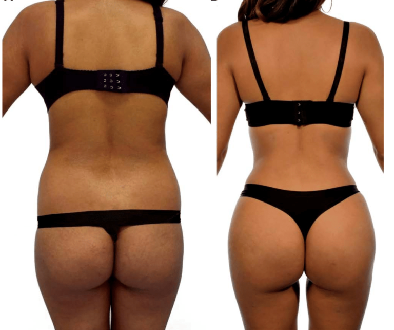 La RibXcar : Quand la Chirurgie Révèle les Absurdités de l’Identité