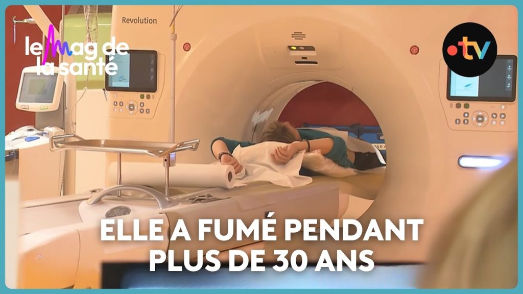 Scanner thoracique : une avancée pour la détection précoce du cancer du poumon en France.