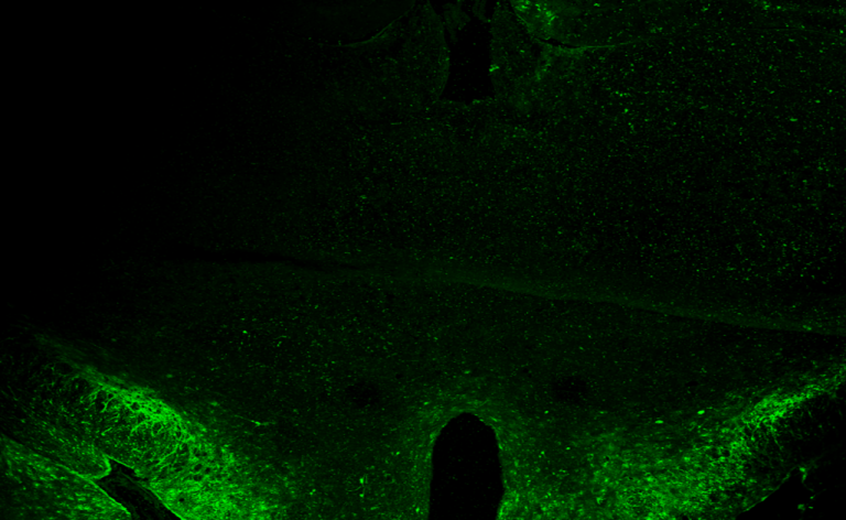 Et si la clé de la longévité cellulaire déclenchait l&rsquo;obésité ?