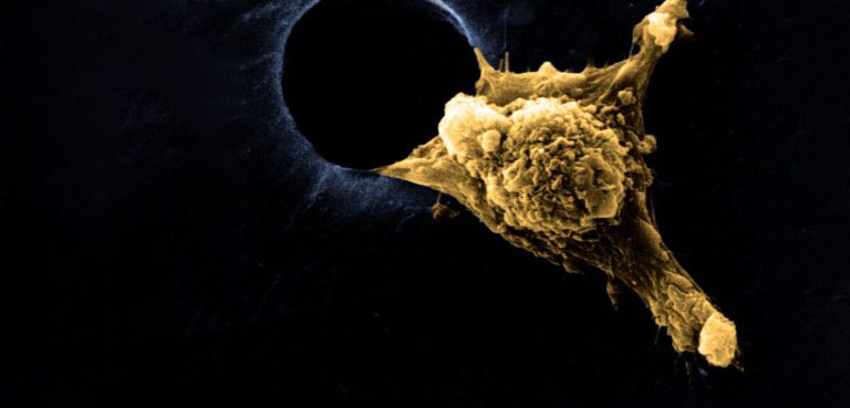 Les cellules qui rampent : un ballet tragique de la vie et du cancer